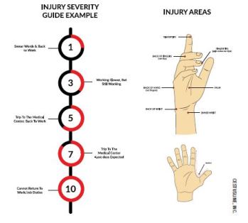If the area of injury is refined in the incident report to cover the palm, dorsal, and side areas, it is easier to identify protection gaps for future PPE improvement in the problem zones. (Cestusline, Inc. graphic)
