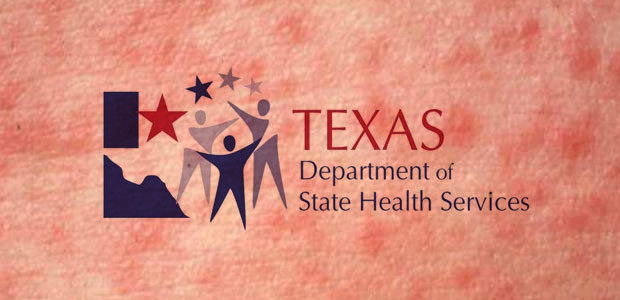 Texas Health Agency Issues Measles Alert