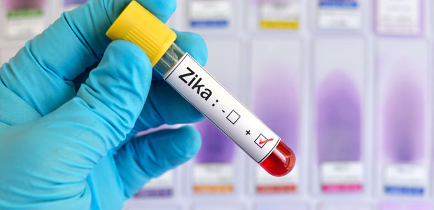 FDA Advises Testing for Zika in all Donated Blood