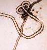 This image from a CDC Q&A page shows an electron micrograph of Ebola virus.