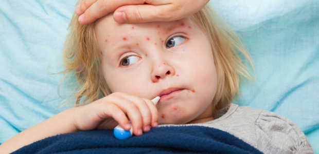 The department has identified more than 1,000 contacts from the initial group of identified measles cases in Arizona.