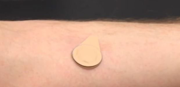The microneedle patch will make vaccinations much easier to administer, even in remote areas, according to CDC, which is developing it with the Georgia Institute of Technology.