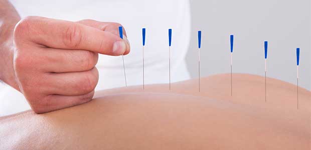 CMS Proposes Coverage of Acupuncture as Alternative to Prescription Opioids
