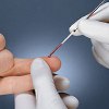 Fingersticks as part of health screenings are increasingly common