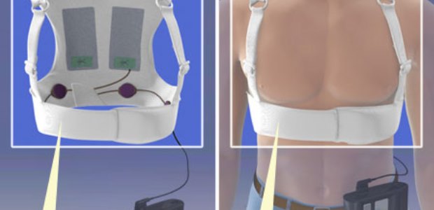 The LifeVest defibrillator has received FDA approval for use by children who weigh at least 41 pounds and have a chest size of 26 inches or more, about the size of an average 8 year old. (Zoll photo)