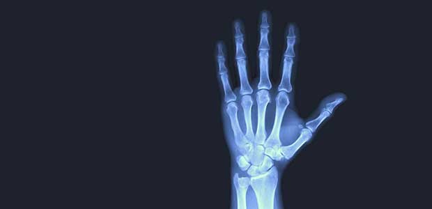 Interpreting ANSI/ISEA 138:2019 Glove Impact Results