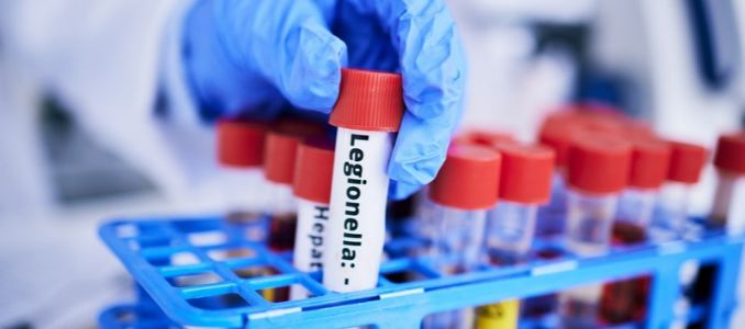 Gloved hand holding a sample tube labeled Legionella.