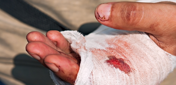 No one knows the frontlines of job site hand injuries like the medical professionals who treat them.