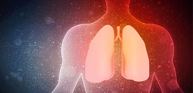 Airborne Dust Exposure and Hypersensitivity Pneumonitis